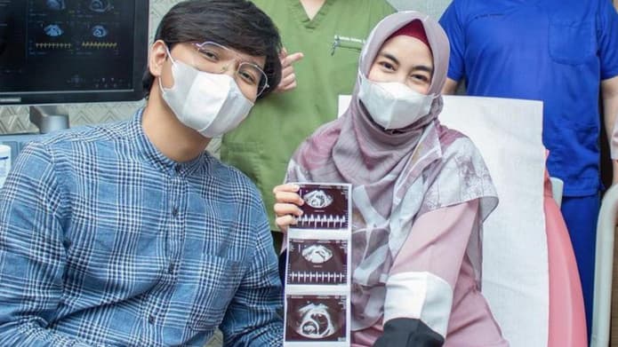 Penantian 4 Tahun, Inilah 9 Potret Bahagia Anisa Rahma dan Suami Umumkan Kehamilan
