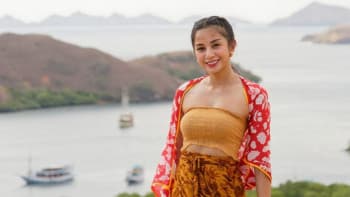 Kirana Larasati Pernah Punya Keinginan Opersi Plastik jadi Jelek, Ini Alasannya