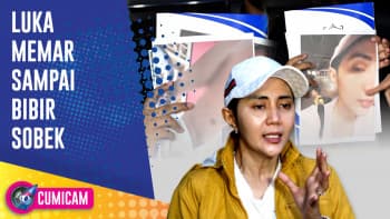 Miris! Aida Zaskia Dianiaya Sahabat Ditengah Berjuang Melawan Kanker Payudara dan Sakit Bipolar