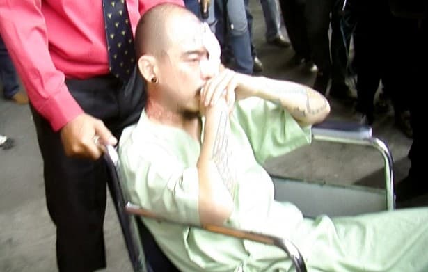 Sebelum Disiram Air Keras, Barry 'Saint Loco' Foto Bareng Pelaku