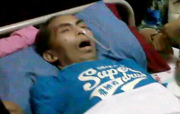 Sakit, Tata Dado Tak Bisa Berkomunikasi