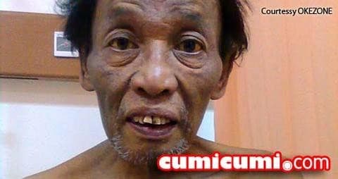 Tak Punya Biaya, Pelawak Cholik Divonis Kanker Hati