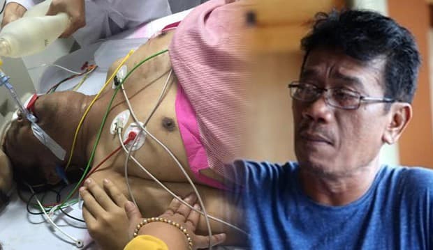 Penyanyi Lawas Eddy Silitonga Meninggal Dunia