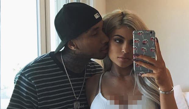 Ke Dokter Kandungan, Kylie Jenner Hamil Anak Tyga?