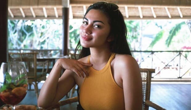 Bantah Oplas, Tapi Ariel Tatum Ngaku Sedot Lemak Pipi
