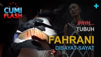 Ihhh...  Tubuh Fahrani Disayat-sayat