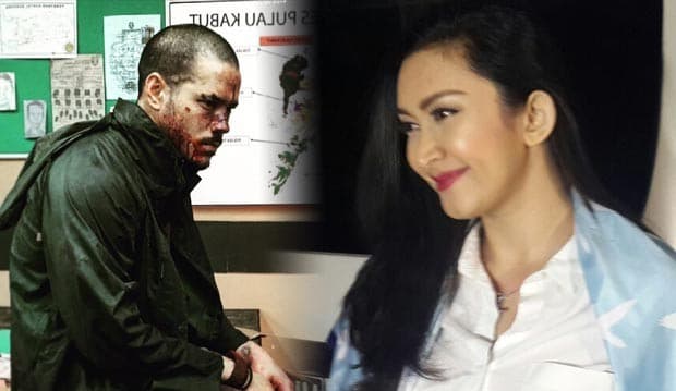 Jatuh dari Motor, Zack Lee Cedera dan Luka Parah