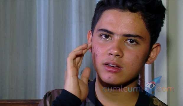 Bukan Jerawatan, Aliando Syarief Alergi Seafood