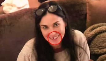 Stres Berat, Gigi Demi Moore Sampai Copot