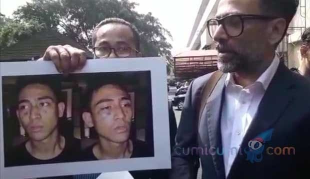 Isu Narkoba, Begini Kehidupan Axel Matthew Selama di London