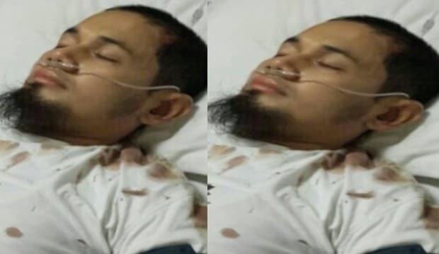 Ditabrak Motor Hingga Pendarahan di Kepala, UGB Harus Terapi