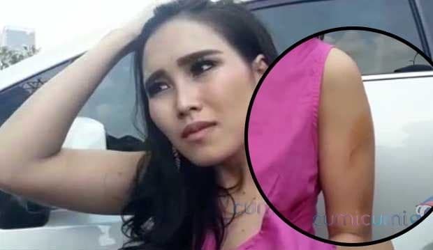 Ayu Ting Ting Dibanting Hingga Memar di Lengan, Ibunda Protes Keras