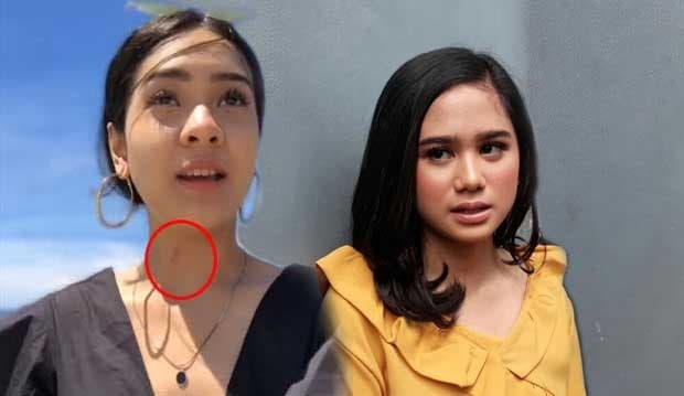 Leher Anya Geraldine Dicupang Bio One? Begini Reaksi Tissa Biani