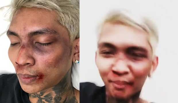 Babak Belur Dipukuli K-popers Garis Keras, Ternyata Young Lex Cuma Akting