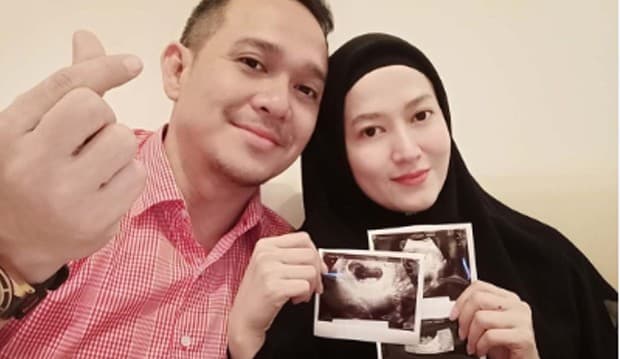Fadlan Muhammad Akhirnya Antar Lyra Virna Cek Kandungan, Perdana Dengar Detak Jantung Bayi